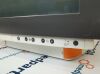 SIEMENS 6GF6300-1BL01 Monitor Rad/Fluoro Room