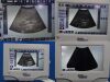 BARD Site Rite Vision Ultrasound - Cardiac - Vascular