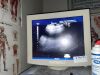 MEDISON 3D4 - 7EK 3D ultrasound probe