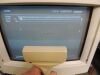 SIEMENS 7.5L75S Linear Ultrasound Transducer