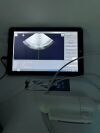 VITACON Lamina VitaScan LT Ultrasound - Urology
