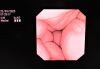 OLYMPUS GIF-XP180N Gastroscope