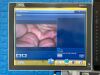 KARL STORZ 3D 222040 20 Tower 3D screen Image 1 Hub 222010 20 With H3-Z Camera Laparoscope