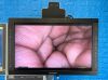 KARL STORZ 3D 222040 20 Tower 3D screen Image 1 Hub 222010 20 With H3-Z Camera Laparoscope