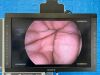 KARL STORZ 3D 222040 20 Tower 3D screen Image 1 Hub 222010 20 With H3-Z Camera Laparoscope