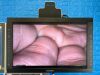 KARL STORZ 3D 222040 20 Tower 3D screen Image 1 Hub 222010 20 With H3-Z Camera Laparoscope