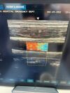 ESAOTE  MYLAB TOUCH ULTRASOUND SYSTEM Ultrasound - Vascular - Small Parts