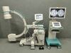 ZIEHM Solo C-Arm