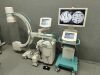 ZIEHM Solo C-Arm