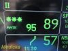 GE Dash 4000 Multi-parameter Monitor