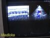 PHILIPS S12-4 Sector Array Ultrasound Transducer