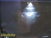 PHILIPS S12-4 Sector Array Ultrasound Transducer