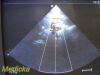 PHILIPS S12-4 Sector Array Ultrasound Transducer