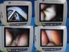VERATHON 2018  0570-0338 Glidescope Video Monitor
