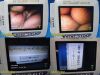 VERATHON Medical P/N 0570-0338 Glidescope Video Monitor