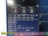 FUKUDA DENSHI DS-7210 Dynascope Patient Monitor