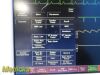 FUKUDA DENSHI DS-7210 Dynascope Patient Monitor