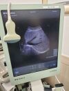 BK MEDICAL 8830 convex