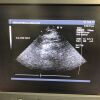 SIEMENS 5V2c Ultrasound Transducer