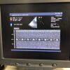 SIEMENS 5V2c Ultrasound Transducer