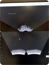 NOMOS SONALIS Ultrasound Imaging System