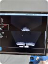 NOMOS SONALIS Ultrasound Imaging System