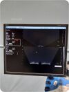 NOMOS SONALIS Ultrasound Imaging System