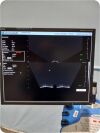 NOMOS SONALIS Ultrasound Imaging System