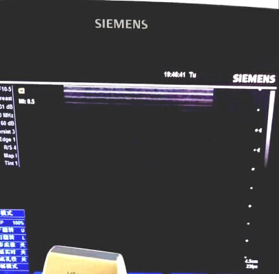 SIEMENS L10-5 Ultrasound Transducer