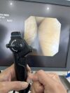 OLYMPUS BF-160 Colonoscope