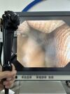 OLYMPUS CF-Q180AI Colonoscope