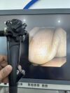 OLYMPUS TJF-160R Colonoscope