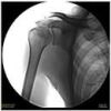 SKANRAY SKAN-C C-Arm
