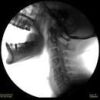 SKANRAY SKAN-C C-Arm
