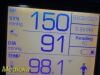 WELCH ALLYN 2013  Hillrom 45NTO Spot Vital Signs LXI Monitor