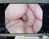PENTAX EC-3490Fi Colonoscope