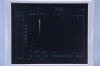 HITACHI Hi-Vision 900 Ultrasound
