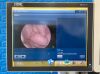 KARL STORZ Spies TC200 TC300 Tower With Spies H3-Z FI TH102 Camera Head Complete Laparoscope