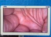 KARL STORZ Spies TC200 TC300 Tower With Spies H3-Z FI TH102 Camera Head Complete Laparoscope