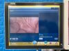 KARL STORZ Spies TC200 TC300 Tower With Spies H3-Z FI TH102 Camera Head Complete Laparoscope