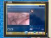 KARL STORZ Spies TC200 TC300 Tower With Spies H3-Z FI TH102 Camera Head Complete Laparoscope