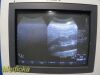 PHILIPS C9-4 Convex Array Ultrasound Transducer