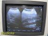 PHILIPS C9-4 Convex Array Ultrasound Transducer