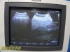 PHILIPS C9-4 Convex Array Ultrasound Transducer