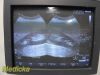 PHILIPS C5-2 Convex Array Ultrasound Transducer