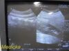 PHILIPS C5-2 Convex Array Ultrasound Transducer