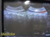 PHILIPS C5-2 Convex Array Ultrasound Transducer