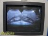 PHILIPS C5-2 Convex Array Ultrasound Transducer