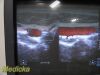 PHILIPS L12-3 Linear Array Ultrasound Transducer