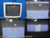 PHILIPS HD11 Ultrasound System W/ L12-5 Linear Array & C5-2 Convex Probe